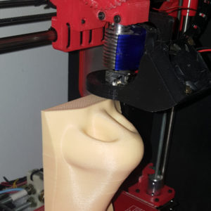 Rhinoplasty 3D Nose Modeling 3D Printing