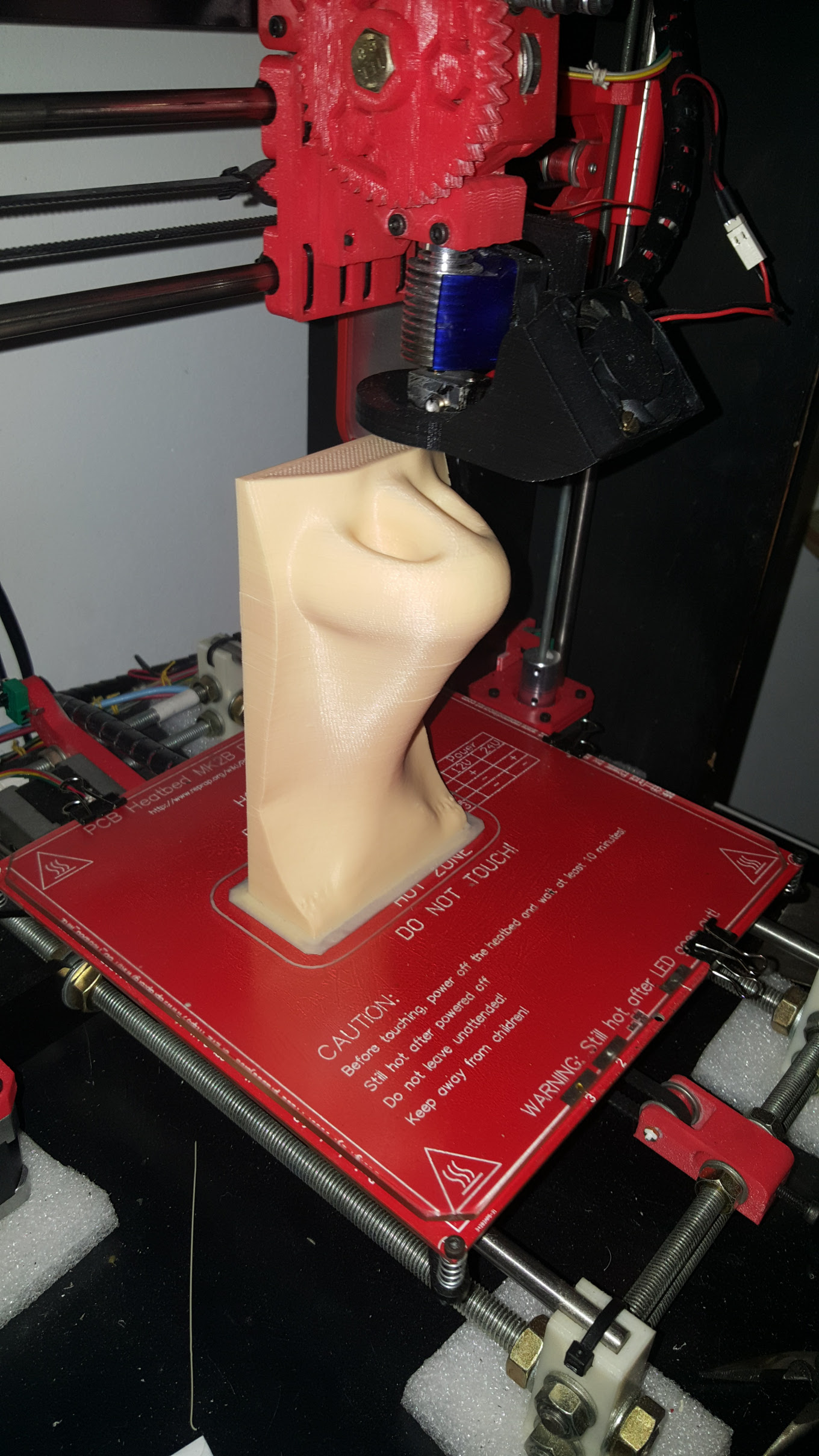 Rhinoplasty 3D Nose Modeling 3D Printing 4